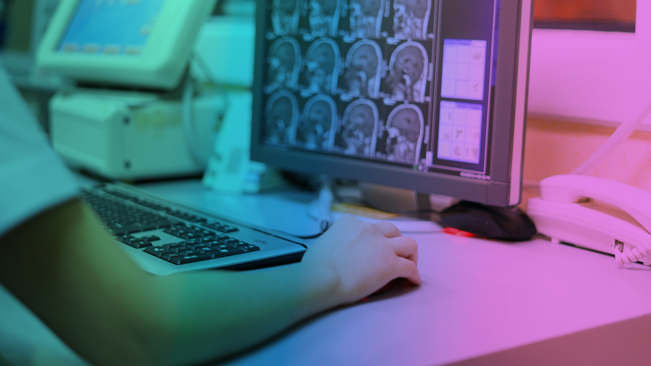 Doctor looking at CT scan images to rule out a possibility of a more severe brain injury