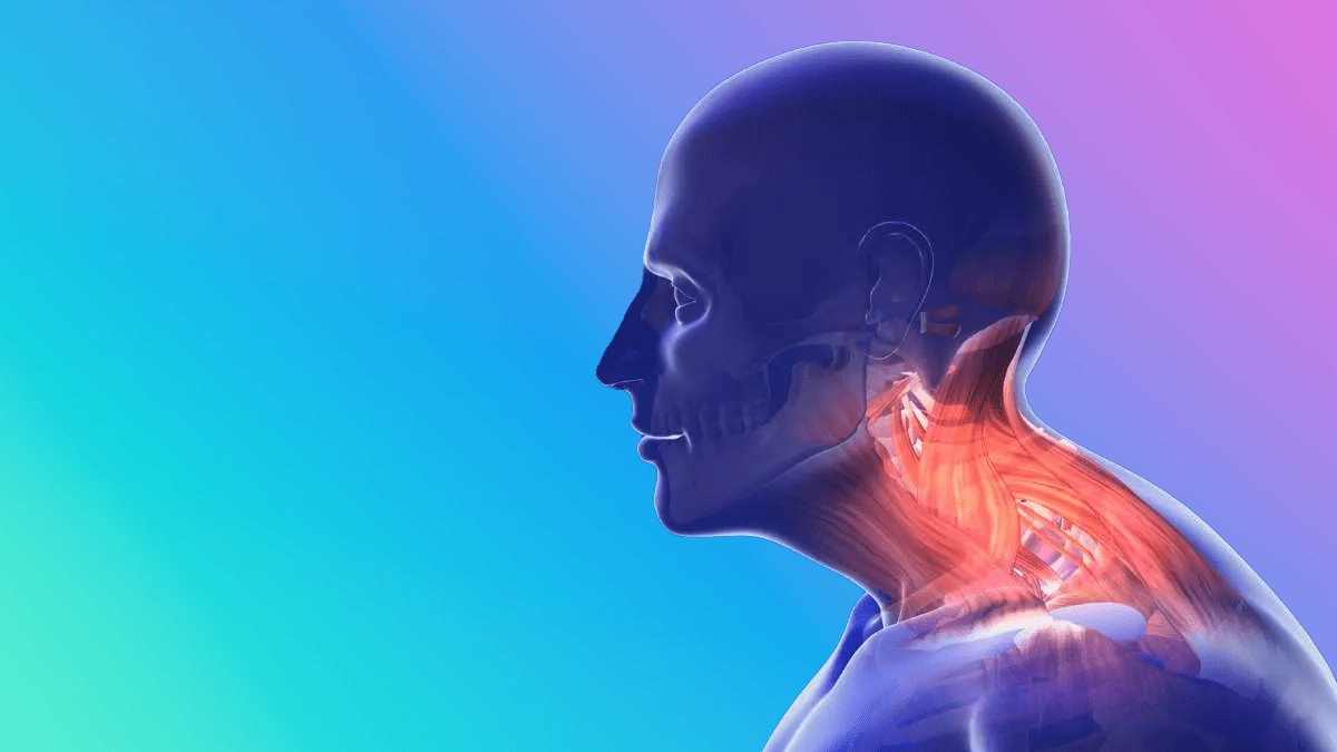 illustration of neck muscles that are strained after sustaining a concussion or whiplash
