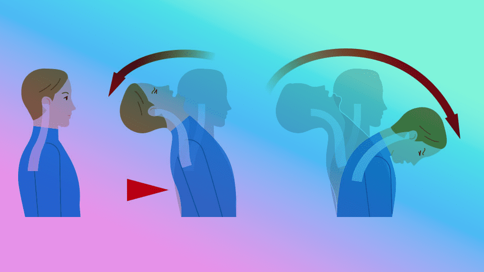illustration of a person's head moving back and forth which can cause whiplash and concussion