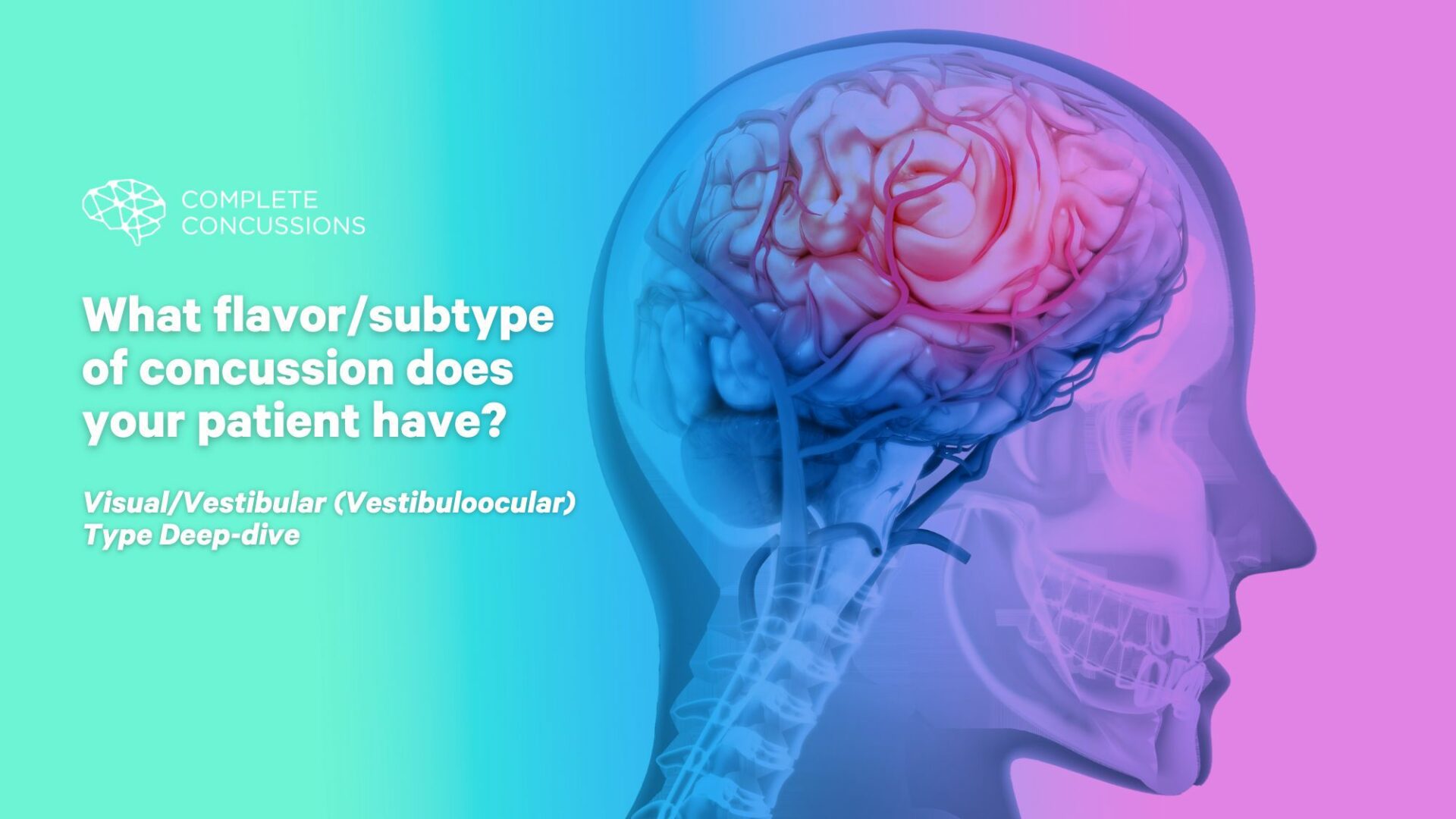 What Flavor/Subtype of Concussion Does Your Patient Have? Visual/Vestibular (Vestibuloocular) Type Deep-Dive